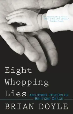 Deal Eight Whopping Lies and Other Stories of Bruised Grace (Paperback)