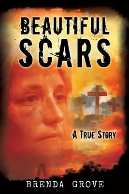 Premium Beautiful Scars (Paperback)